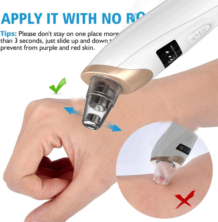 Blackhead Remover