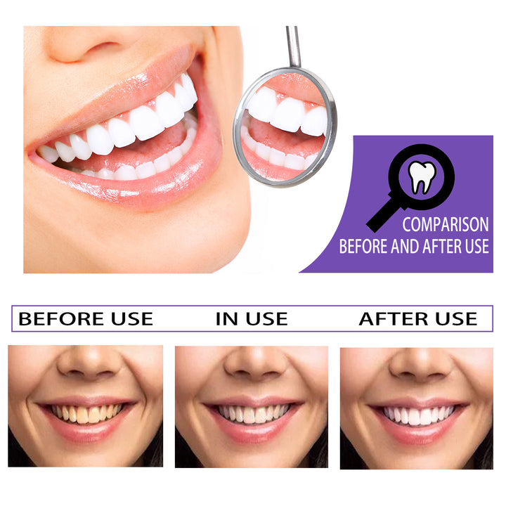 Teeth Whitening Toothpaste_before and after